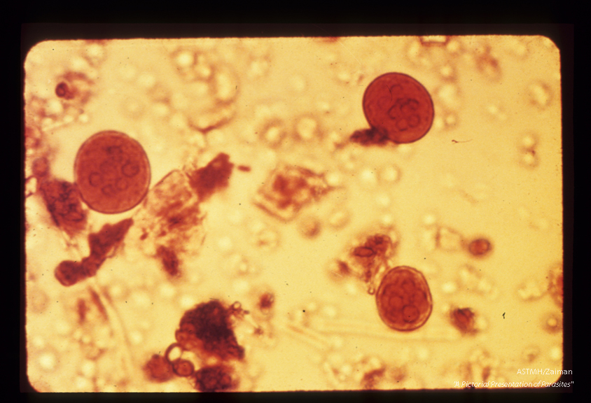 Cysts. Iodine stain. More than four nuclei are seen in the cysts.