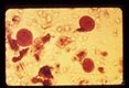 Cysts. Iodine stain. More than four nuclei are seen in the cysts.