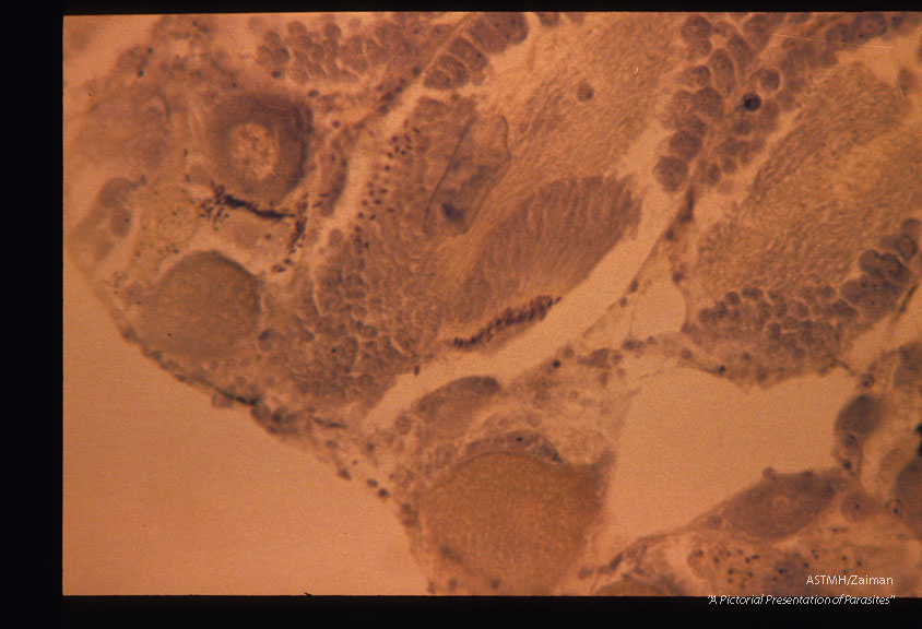 Section through normal snail liver.