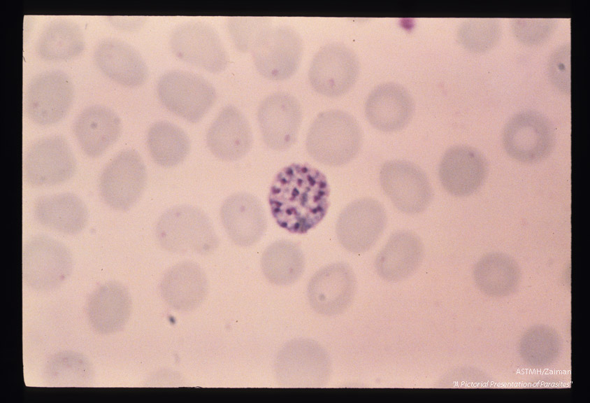 Schizogony from binucleate through multinucleate stages is demonstrated