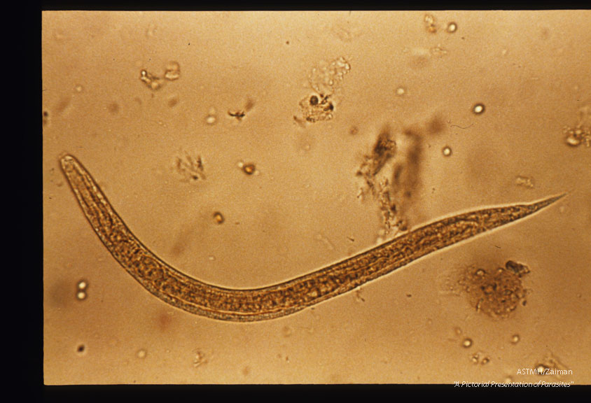 Rhabditiform larva in stool.