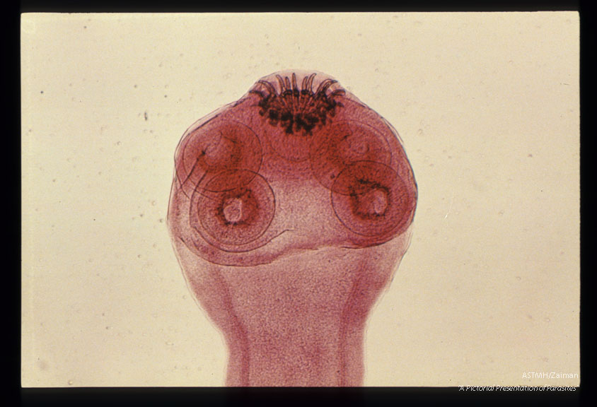 Scolex evaginated from a cysticercus.