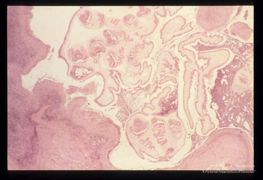 Multiple sections showing membranes, suckers and hooks.