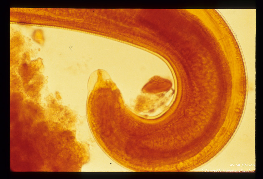 Posterior end of male showing genital organs. Iodine stained.
