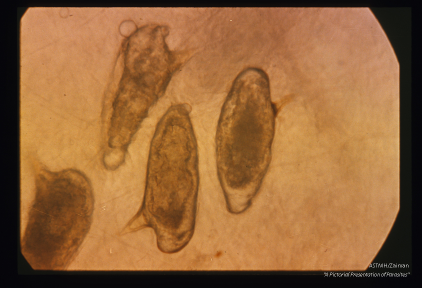 Eggs in press preparation. These eggs contain larvae and are apparently older than those in slide 80.