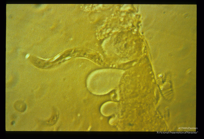 Microfilaria beginning to penetrate the midgut epithelium of Aedes aegypti (interference contrast).