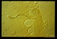Microfilaria beginning to penetrate the midgut epithelium of Aedes aegypti (interference contrast).