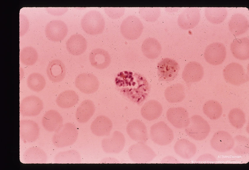 Two parasites simultaneously undergoing schizogony in one host cell.