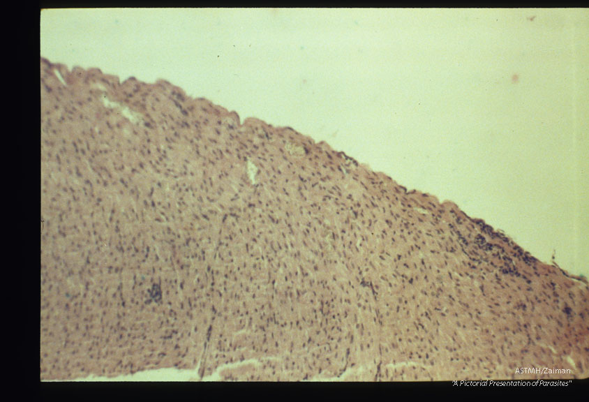 Pericardial lesion. Experimental trichinous myocarditis in rats.