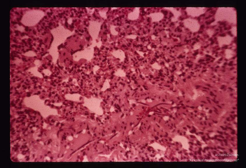 Microfilaria in dog lung.