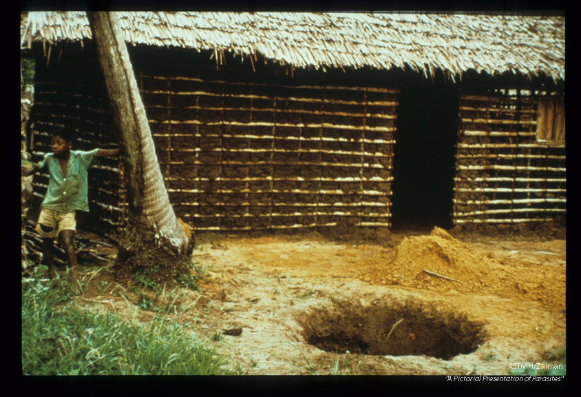 Tanzania. Mosquitoes breed in pit latrines like the one being dug here. Transmission occurs at night when mosquitoes invade houses via the eaves. Prevention might be achieved by screening and/or residual insecticides sprayed on walls where heavy mosquitoes rest after biting.