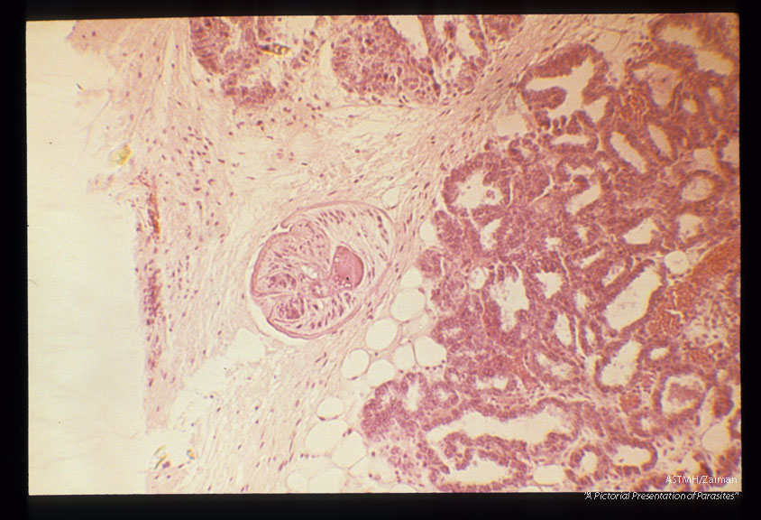 Mesocercarial stage in the connective tissue of mouse mammary gland. Low and high magnifications.