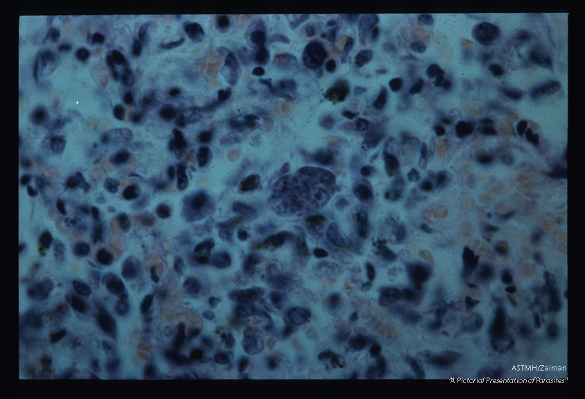 Human lung. Giemsa stain .