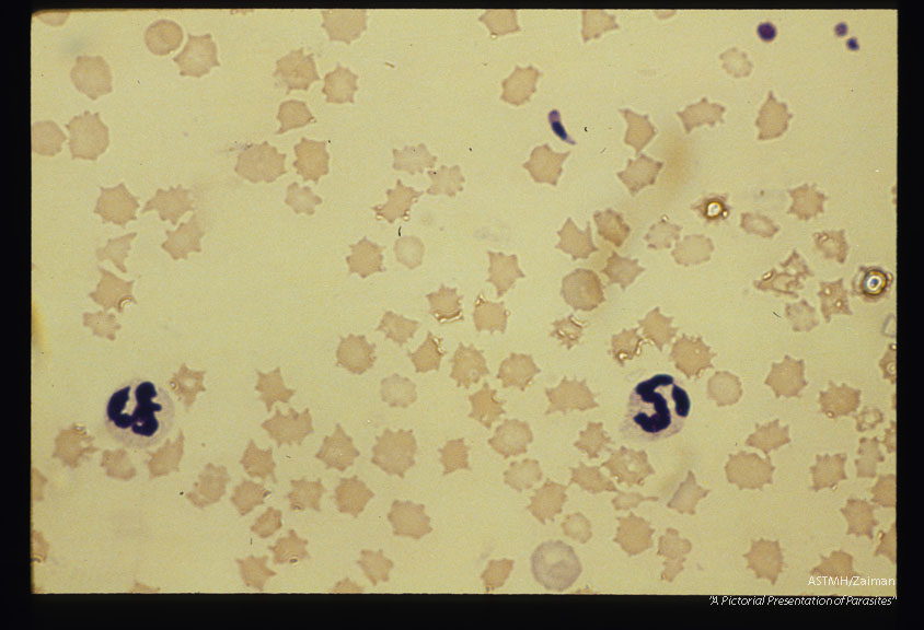 Merozoite free in bovine blood smear.