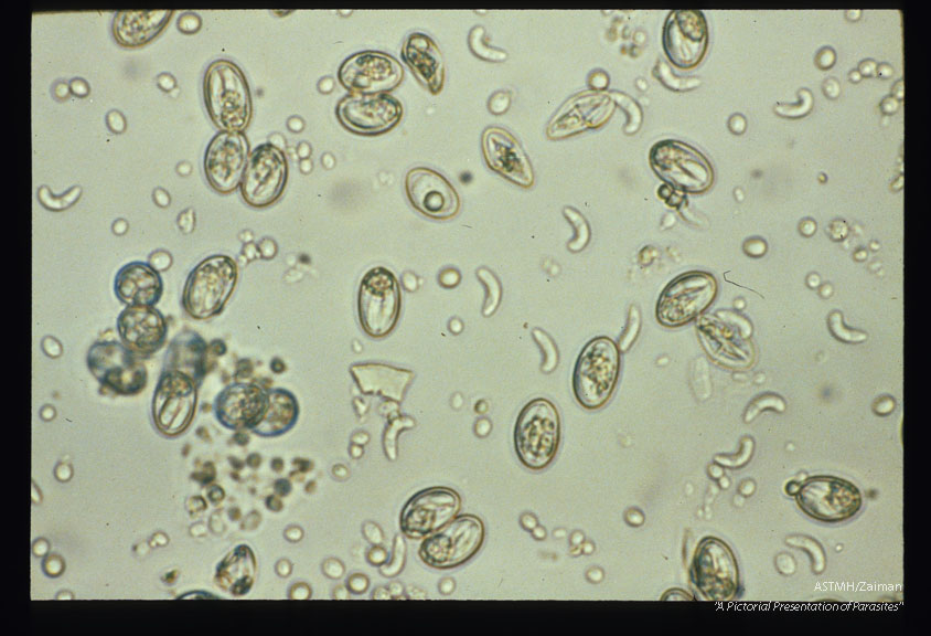 Sporocysts in fecal float from coyote. Sporocysts are excysting releasing sporozoites following incubation in CO2 followed by treatment with bile and trypsin.