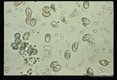 Sporocysts in fecal float from coyote. Sporocysts are excysting releasing sporozoites following incubation in CO2 followed by treatment with bile and trypsin.
