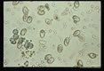 Sporocysts in fecal float from coyote. Sporocysts are excysting releasing sporozoites following incubation in CO2 followed by treatment with bile and trypsin.
