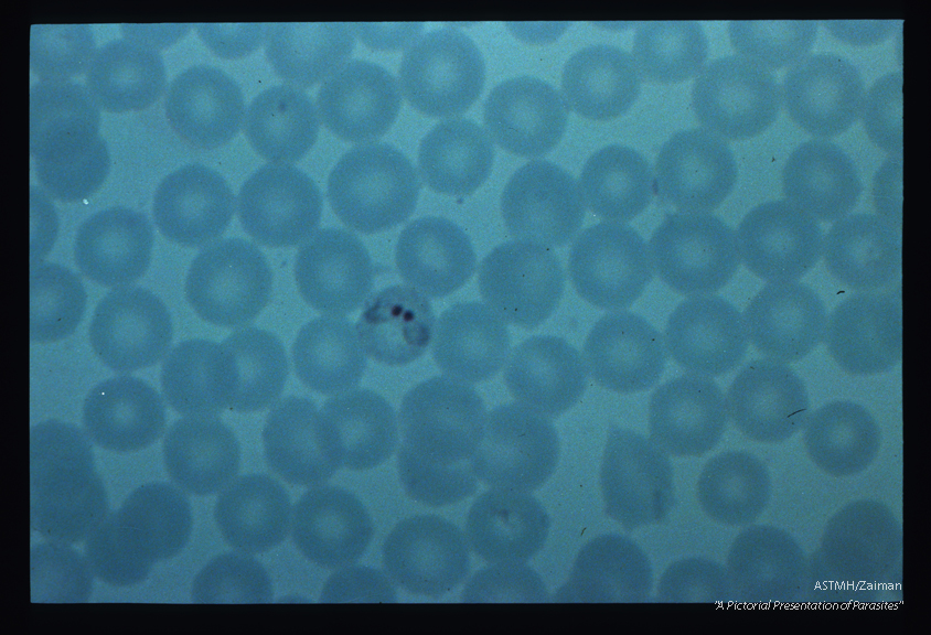 Two rings in one erythrocyte.