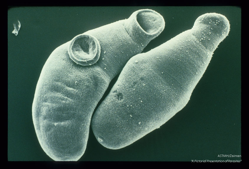 SEM of worms from a 16-day old infection of a mouse.