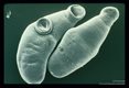 SEM of worms from a 16-day old infection of a mouse.