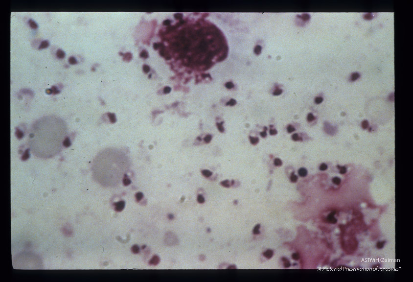 Smear with unusually clear staining of blepharoplast and nucleus.