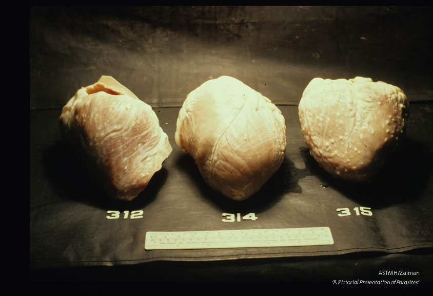 Beef hearts harboring multiple cysticerci.