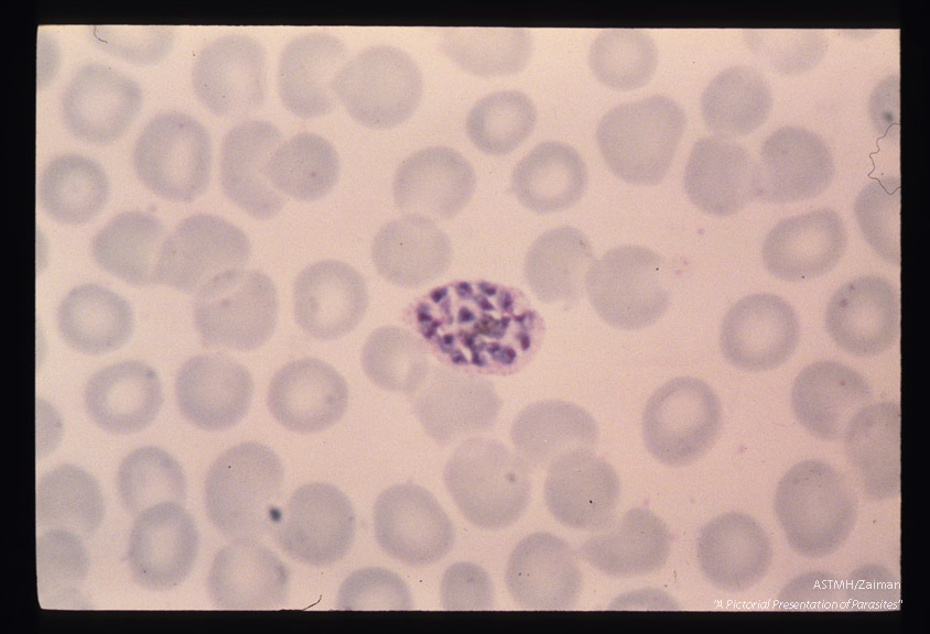 Schizogony from binucleate through multinucleate stages is demonstrated