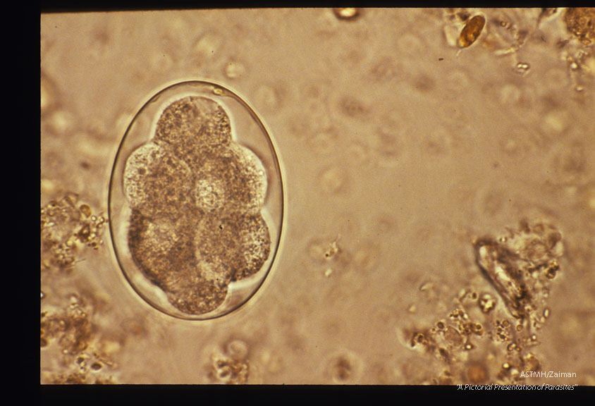 Egg in stool from Liberian patient.