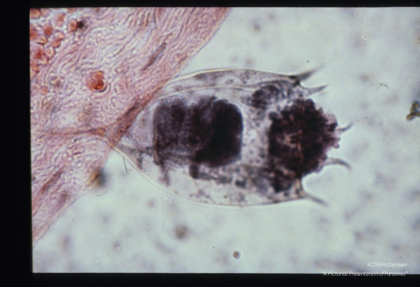 Contaminant on slide.