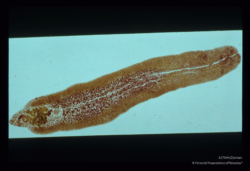 Whole mount. Note the typical anterior cone and branched gut. For size concepts see slide number 117.