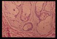 Multiple cross sections of the parasite are seen in this section through the hair follicles of a dog's skin.