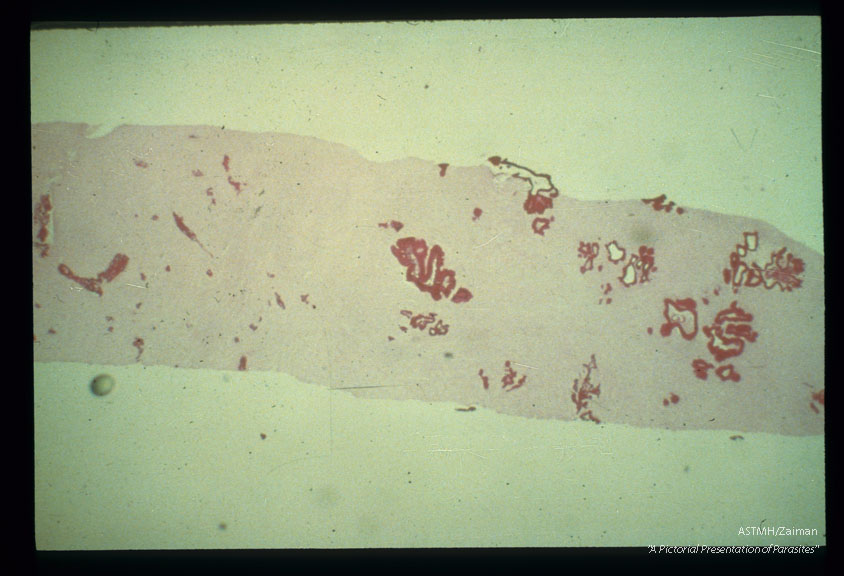 Needle biopsy of human liver.