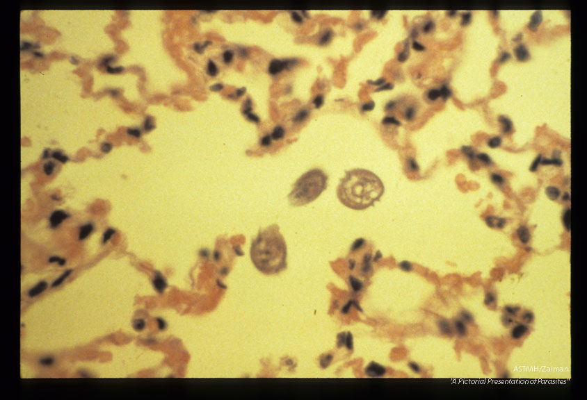 Note lateral alae on larvae within pulmonary alveoli during experimental infection of Erythrocebus patas.