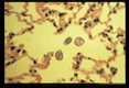 Note lateral alae on larvae within pulmonary alveoli during experimental infection of Erythrocebus patas.