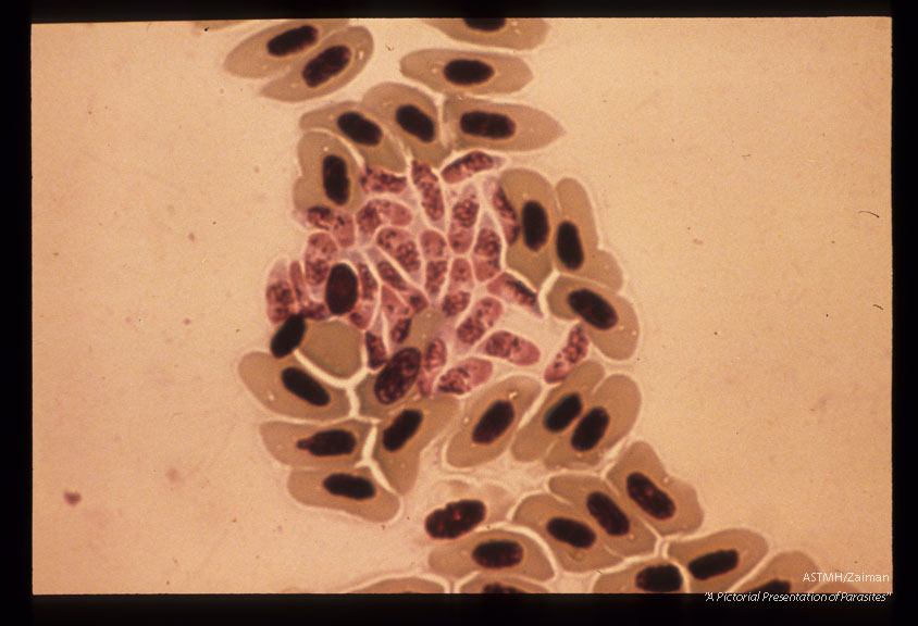 Giemsa stained lung (budgerigar) impression. 6 days PI.