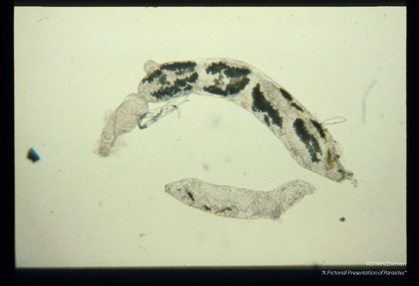 Mature redia containing cercariae.