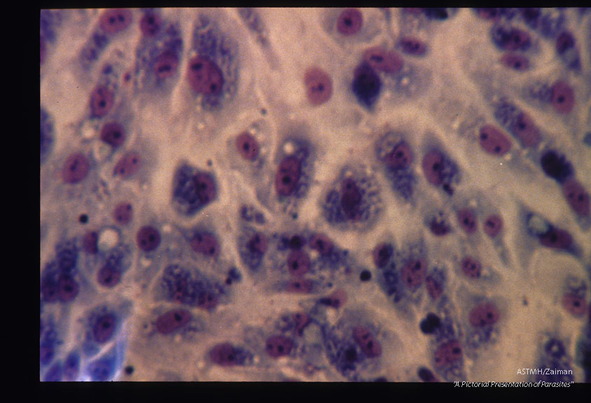 Giemsa stained monkey tissue culture.