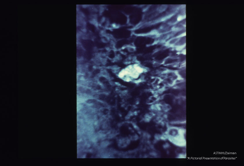 Demonstration of Toxoplasma in retina by fluorescently stained antibody.