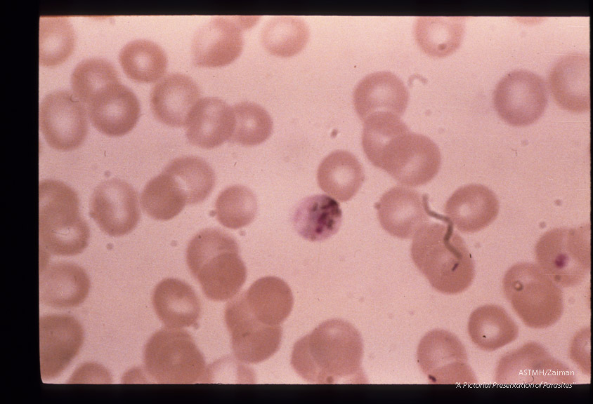 The development of male sexual cells from gametocyte to sperm cells (exflagellation) is shown in this series.