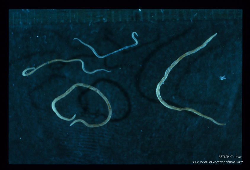 These nematodes are now known to cause eosinophilic meningitis in man.