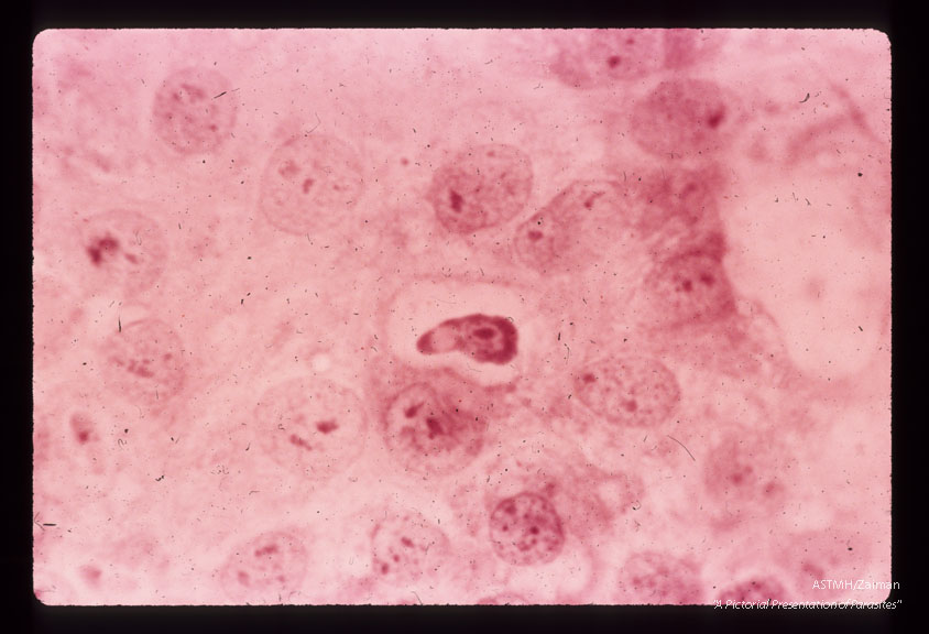 Development of sporozoite into trophozoite. Note parasite nucleus anterior to refractile globule. H & E Stain (18 hr. after inoculation).