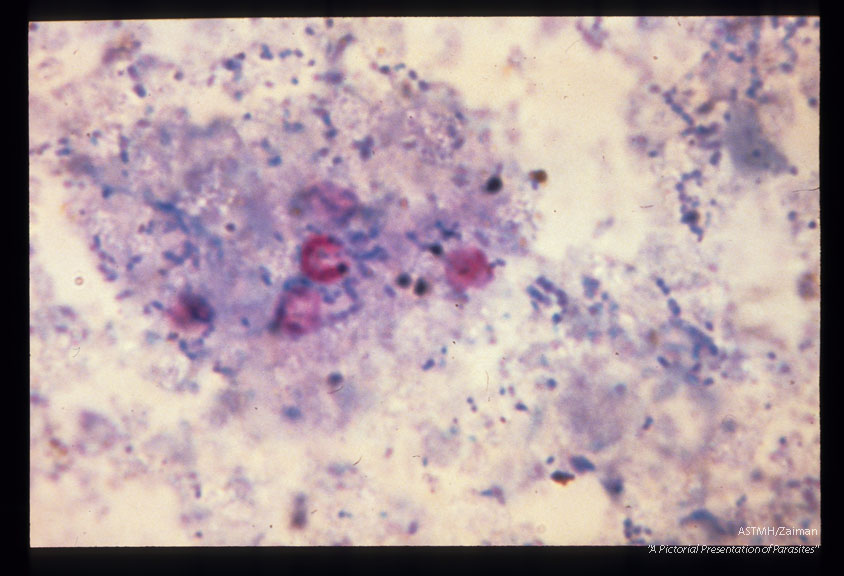 Acid-fast stain of stool specimen.