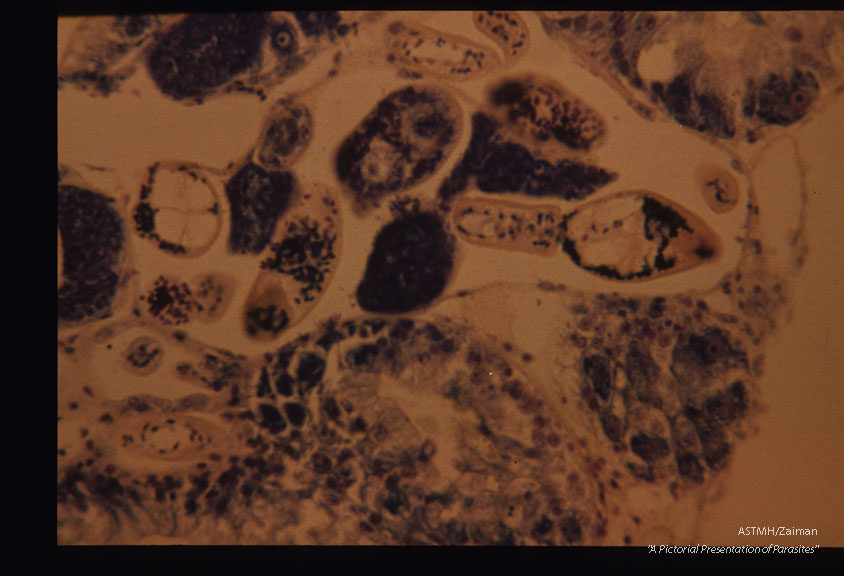 Similar section made 72 days after infection. Fully developed cercariae are present.