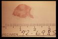 Gross surgical specimen of nodule containing parasite.