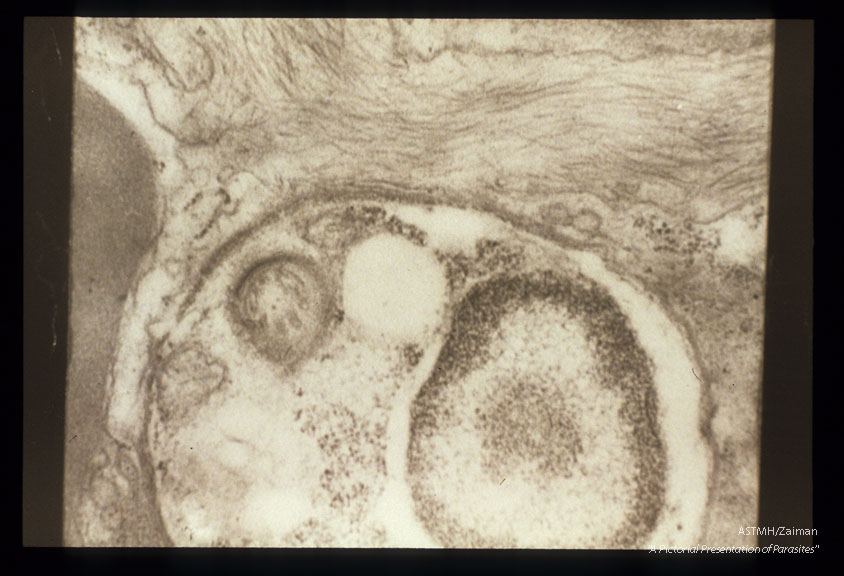 Nucleus, membranes, and other organelles shown in relation to the surrounding host cell, which contains streaks of amyloid.