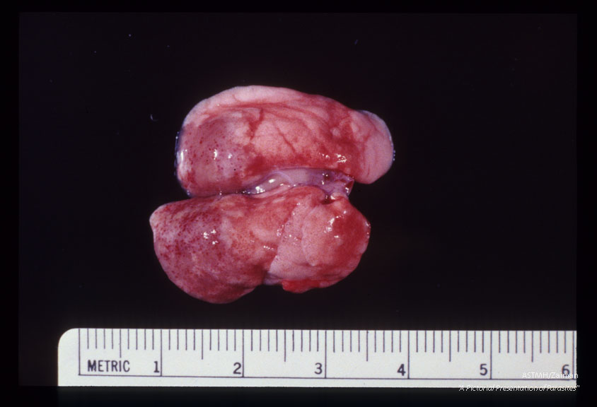 Gross pathology of rat lungs from 50 day old infection with 30 larvae.