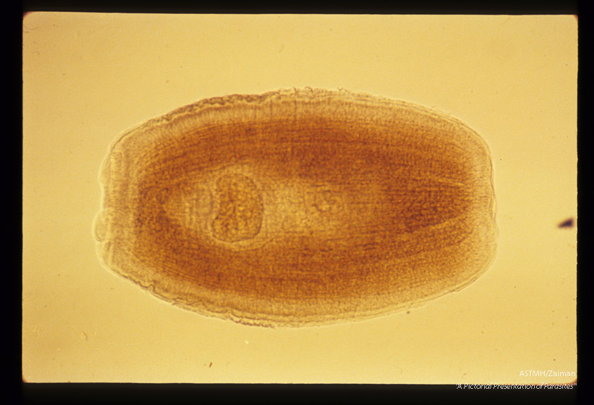 Segments from human case.