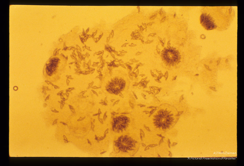 Sand from cyst in human liver showing loose and grouped hooks.