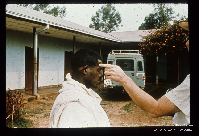 Forehead lesions are unusual in Africa, but they do occur.