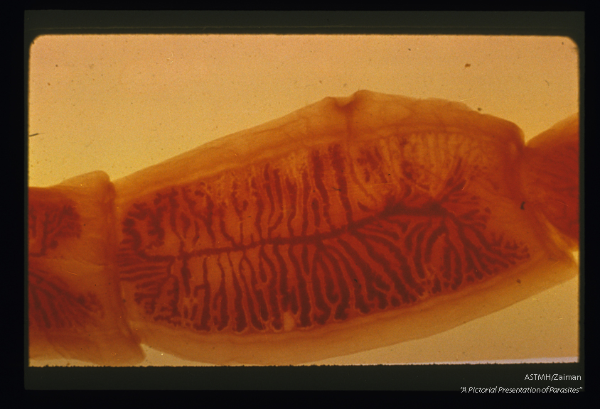 Gravid proglottid. More than 14 lateral branches emerge from the uterus.